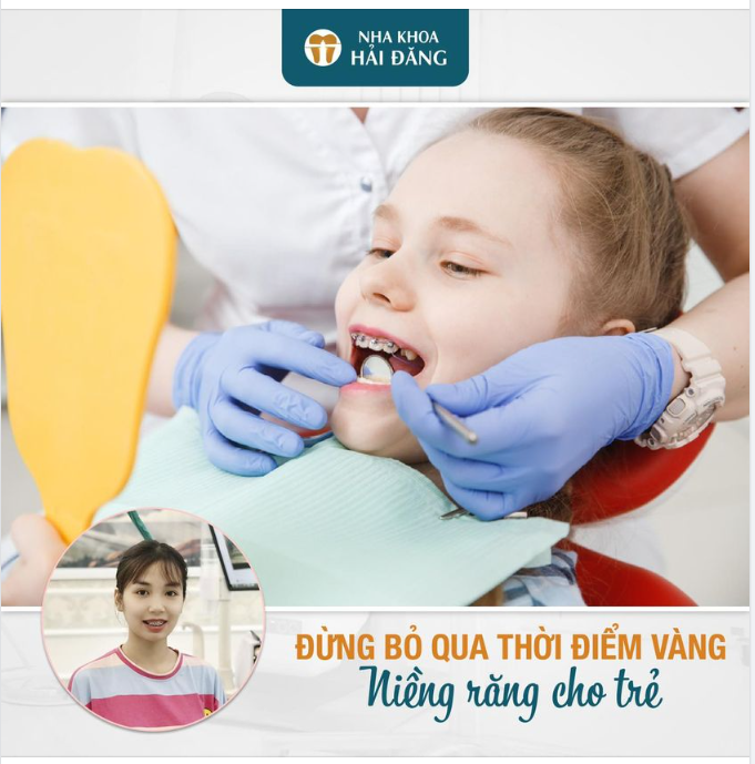 ĐỪNG BỎ QUA THỜI ĐIỂM VÀNG NIỀNG RĂNG CHO TRẺ