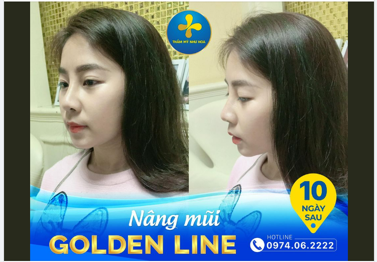 Dừng chân một bước Sau 30 phút “rước” ngay chiếc mũi xinh xắn, cao bay.