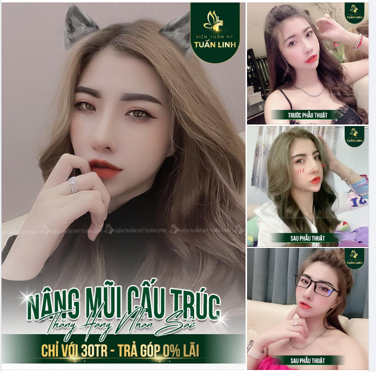 ĐỪNG ĐỂ CHIẾC MŨI THẤP TẸT CẢN TRỞ SỰ TỰ TIN CỦA BẠN