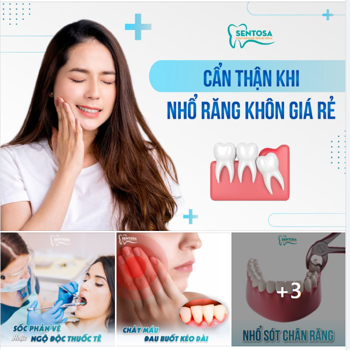 ĐỪNG HAM NHỔ RĂNG KHÔN GIÁ RẺ ĐỂ RỒI PHẢI TRẢ GIÁ ĐẮT