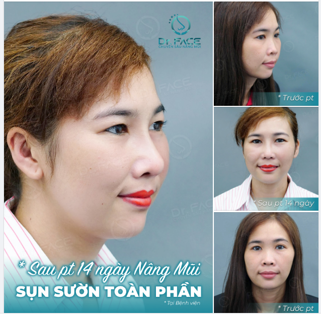 Em yếu tiếng Trung Vì em trúng tiếng yêu…!