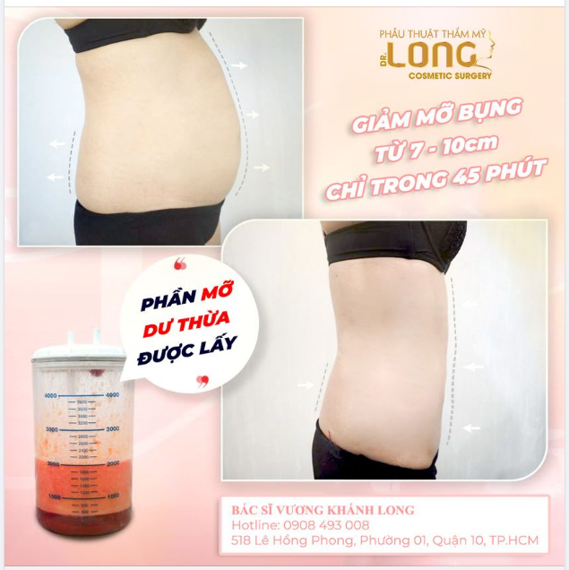 EO ĐẸP DÁNG XINH CHO NÀNG THÊM TỰ TIN