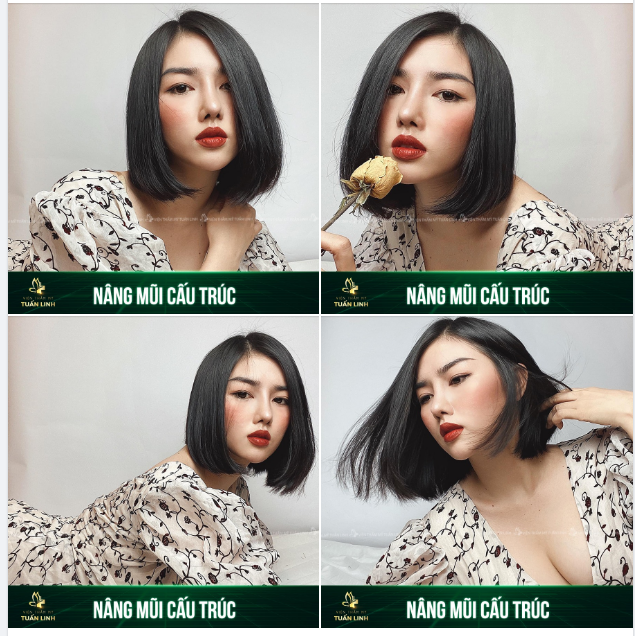FEEDBACK chiếc mũi xinh cho cô nàng 9x