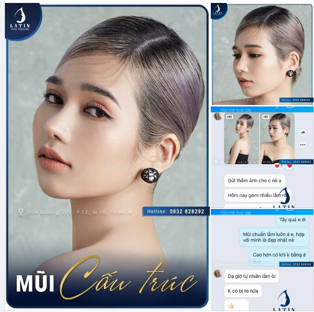 Feedback đầy ngọt ngào từ cô nàng nâng mũi cấu trúc nhà Latin