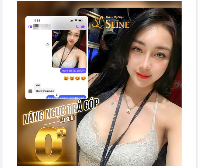 Feedback khách hàng nâng cấp vòng 1 với Ekip Sline