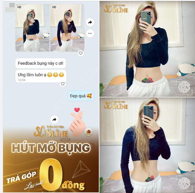 Feedback khách hàng sau giảm mỡ bụng với Ekip Sline