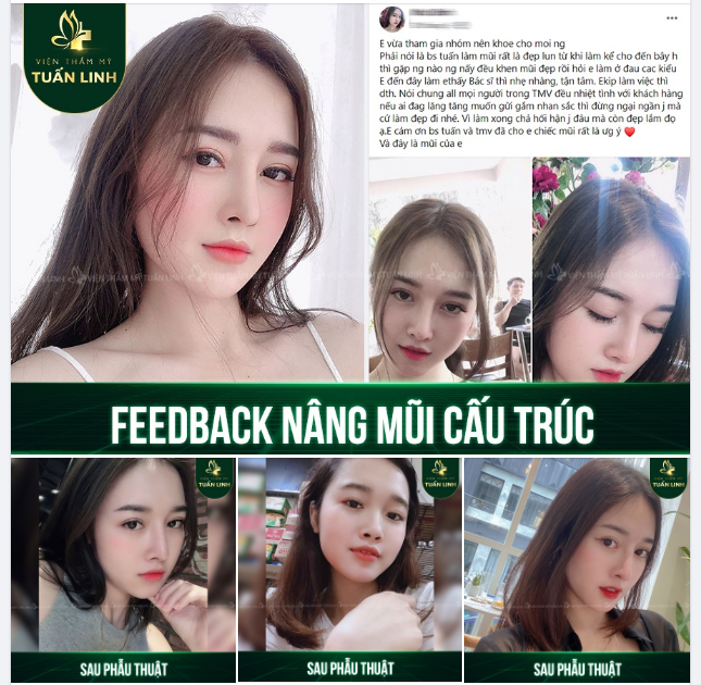FEEDBACK NÂNG MŨI