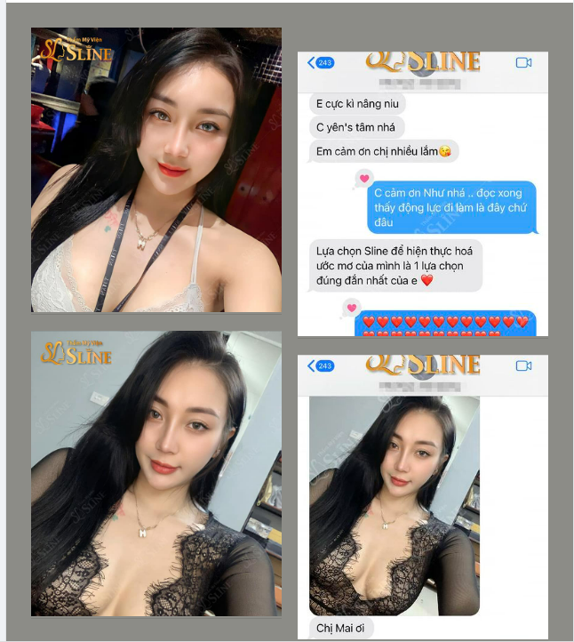 Feedback nâng ngực sau 14 ngày.
