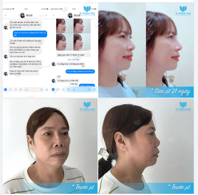 FEEDBACK “NÓNG HỔI” VỪA THỔI VỪA XEM