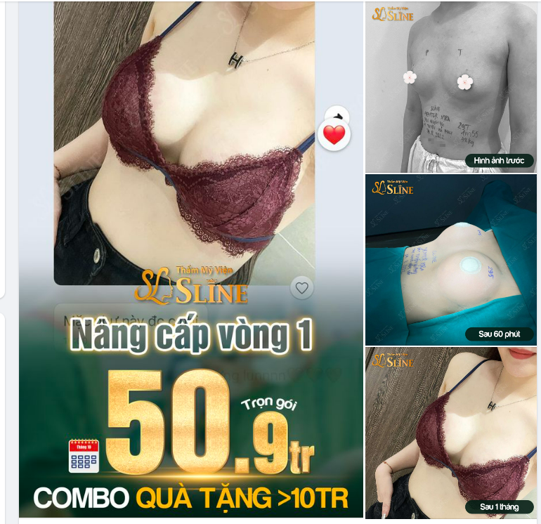 Feedback sau nâng cấp vòng 1