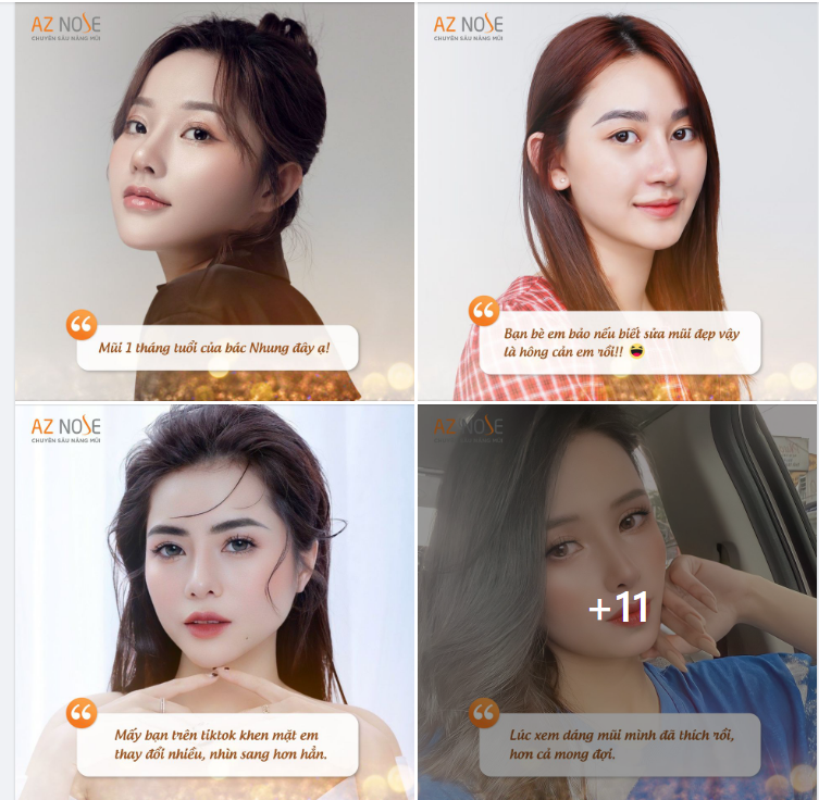 Feedback yêu thương của khách hàng sau nâng mũi