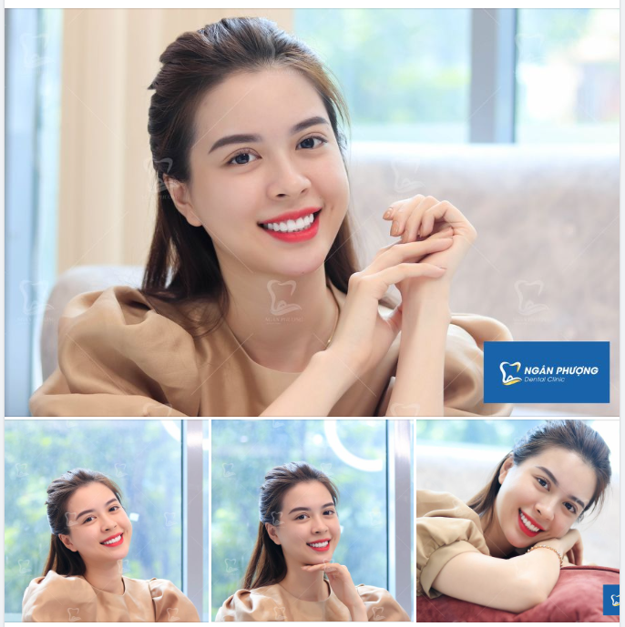 Gió đưa cành trúc la đà Răng xinh duyên dáng thế là tự tin