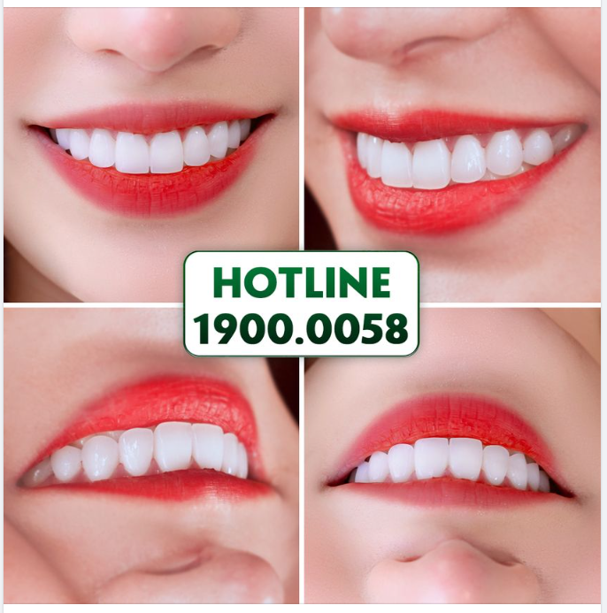 GIỮ TRỌN KHÍ CHẤT RIÊNG - BỪNG SÁNG NỤ CƯỜI ĐẸP