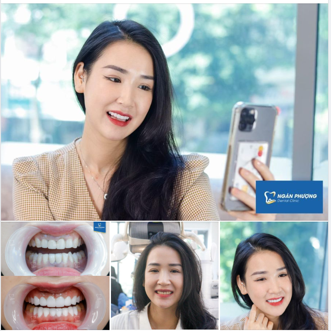 Gọi Nha khoa là kẻ dốt văn, bởi nụ cười này đẹp xinh không tả được