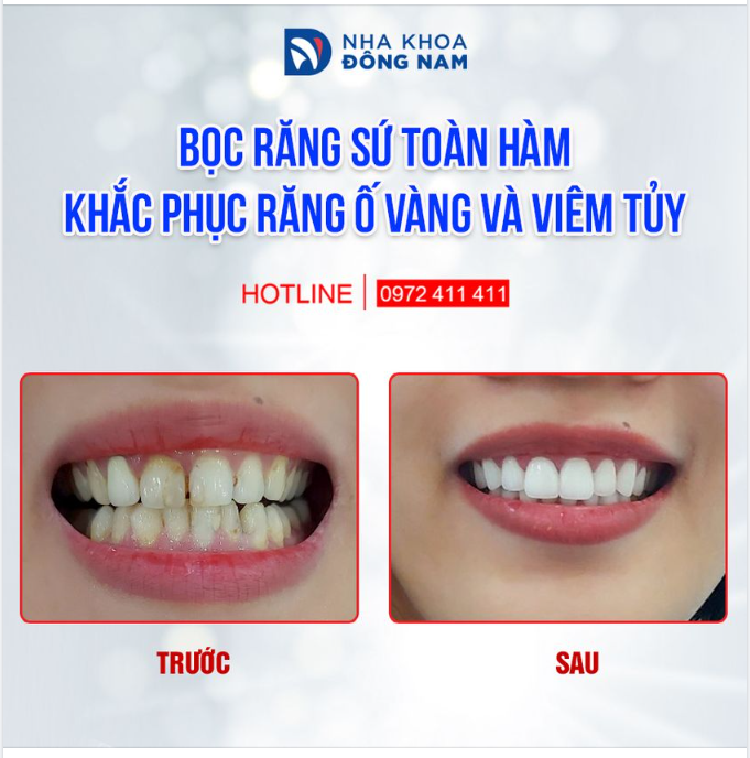 HÃY NHÌN VÀO KẾT QUẢ ĐỂ THẤY ĐẦU TƯ CHO BẢN THÂN LÀ HOÀN TOÀN XỨNG ĐÁNG