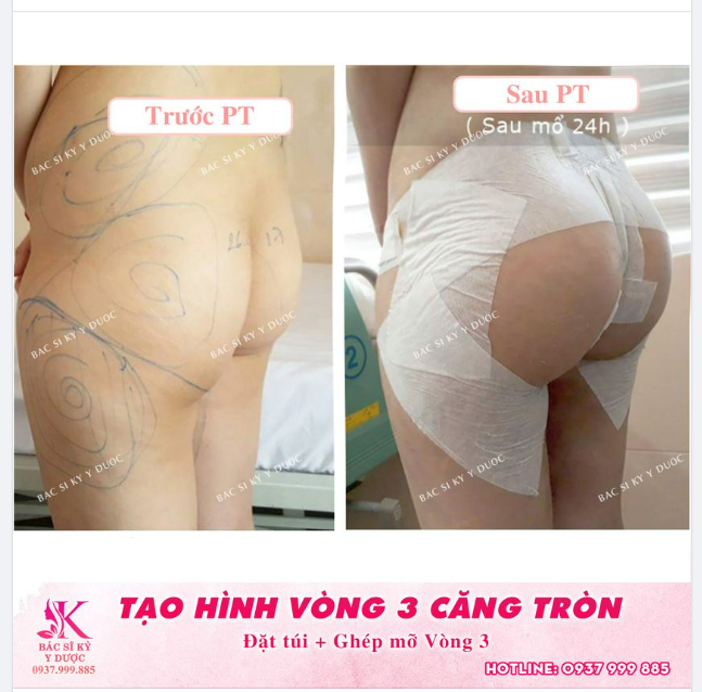 Tổng hợp +50 ảnh gái mông to siêu gợi cảm và sexy