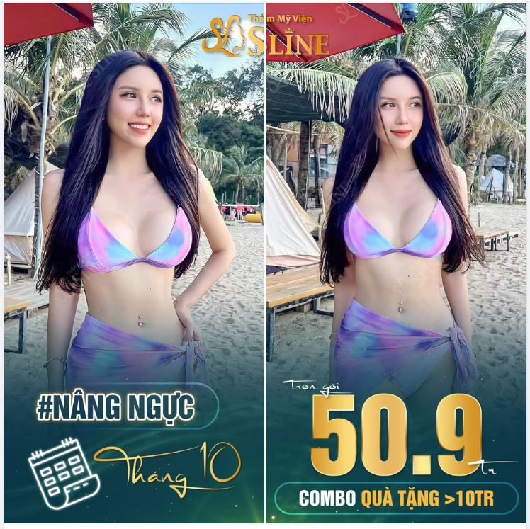 Hình ảnh khách hàng sau nâng cấp vòng 1 với Ekip Sline