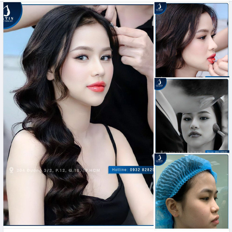 Hô biến nhan sắc - Hóa Hotgirl chỉ nhờ nâng mũi
