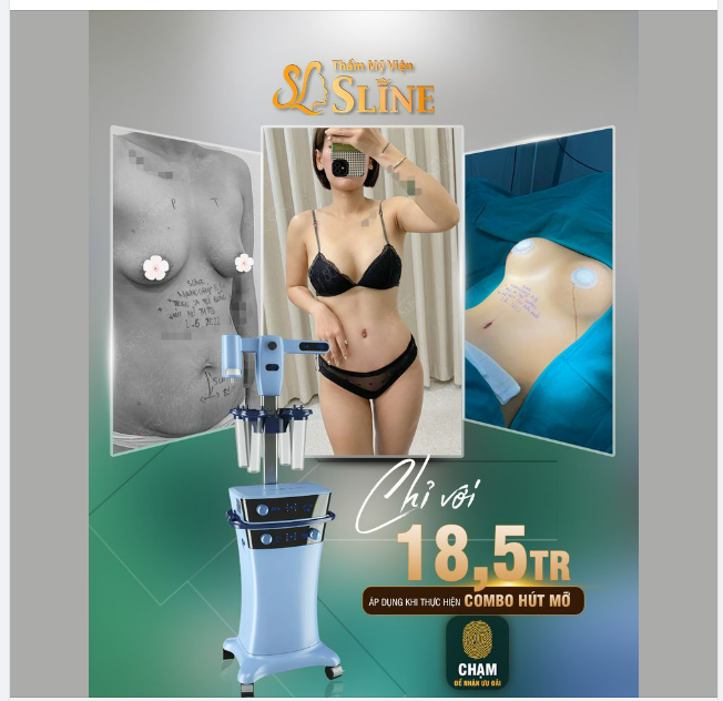 Hót Hót Hút mỡ bụng CHỈ VỚI 18,5TR TRỌN GÓI.