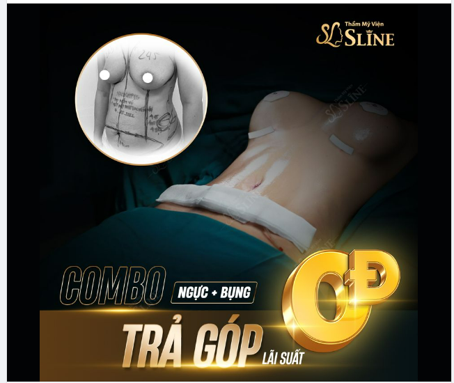 Hút mỡ 0đ Chương trình ưu đãi SIÊU HOT của Sline.