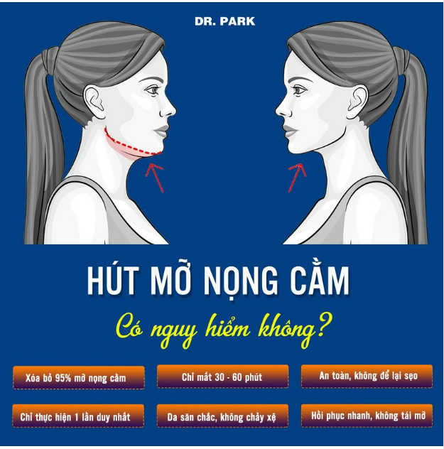 HÚT MỠ NỌNG CẰM - 60 PHÚT HẾT HAI CẰM