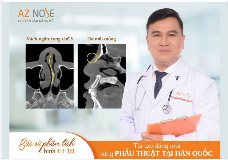 Khắc phục mũi l.ệch - ng.ắn h.ếch cho khách hàng Cần Thơ