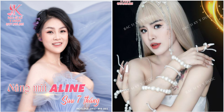 Khoe cả nhà dáng mũi ALINE của 2 bạn khách xinh đẹp nè!