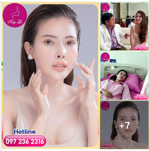 KHÔI PHỤC VẺ ĐẸP HOÀN MỸ CHO CHIẾC MŨI HỎNG