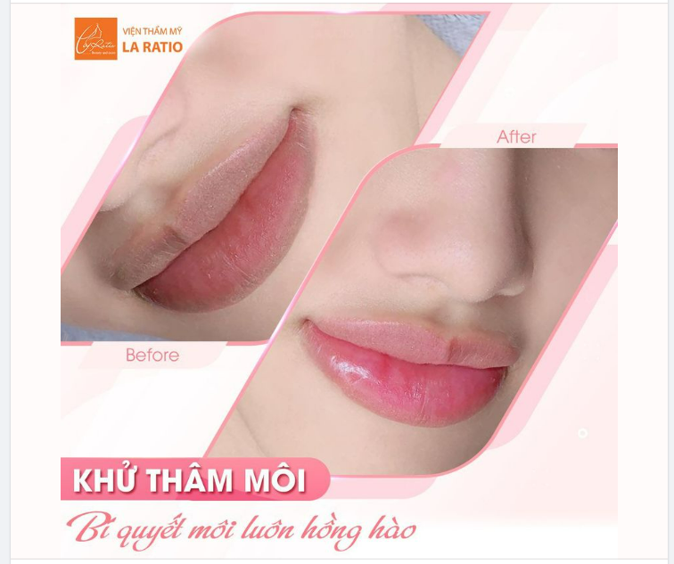 Khử thâm môi Organic  BÍ QUYẾT MÔI LUÔN HỒNG HÀO