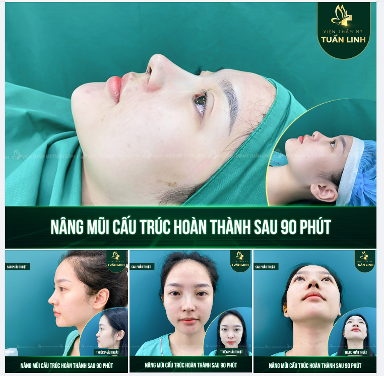 LÀM ĐẸP LÀ KHÔNG CHỜ ĐỢI