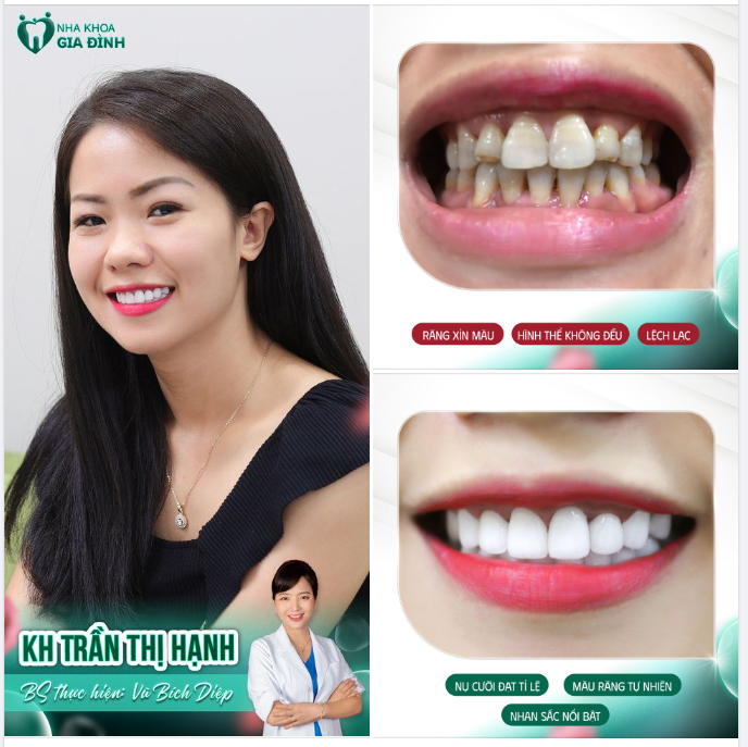 LÀM RĂNG AN TOÀN VỚI BÁC SĨ CHUYÊN MÔN CAO - CÔNG NGHỆ HIỆN ĐẠI
