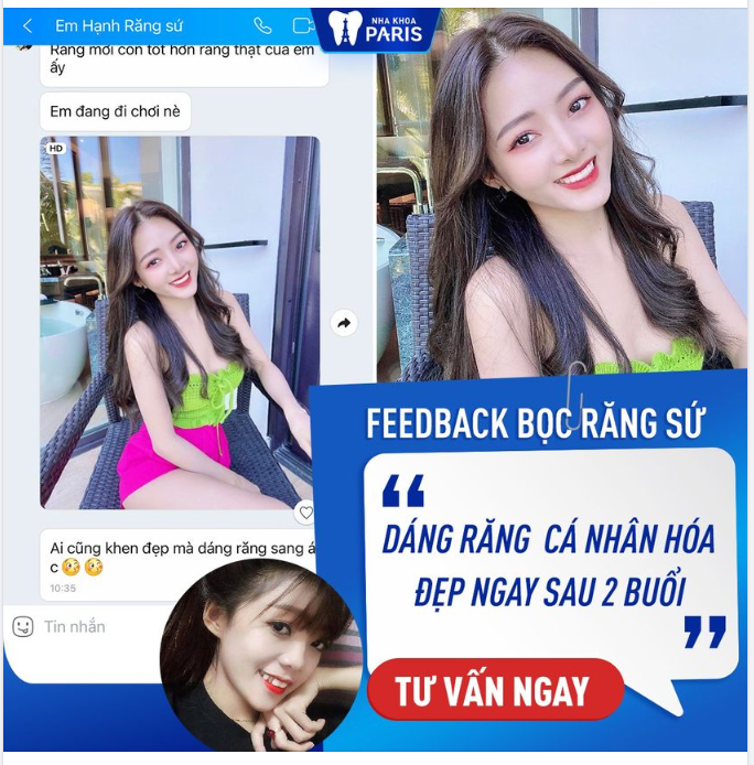 Làm răng sứ 6S Maxbeauty - Xu hướng 2022 được các Hotgirl đình đám lựa chọn
