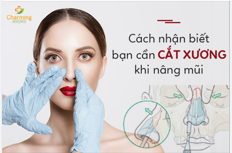 LÀM SAO ĐỂ NHẬN BIẾT BẠN CẦN CẮT XƯƠNG KHI NÂNG MŨI