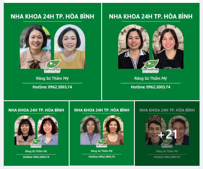 LÀM THẨM MỸ RĂNG SỨ - GIÚP CUỘC SỐNG TƯƠI ĐẸP HƠN