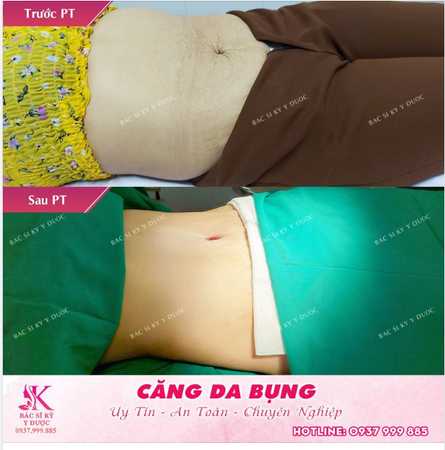 Làm thế nào để sở hữu vòng eo con kiến nhanh nhất