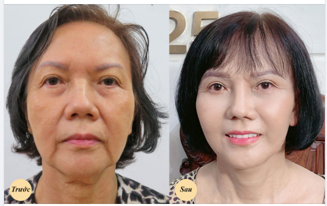 Lắng nghe câu chuyện của cô khách Việt Kiều sau bao năm nơi đất người, nay đã trở về quê hương sum họp bên gia đình.
