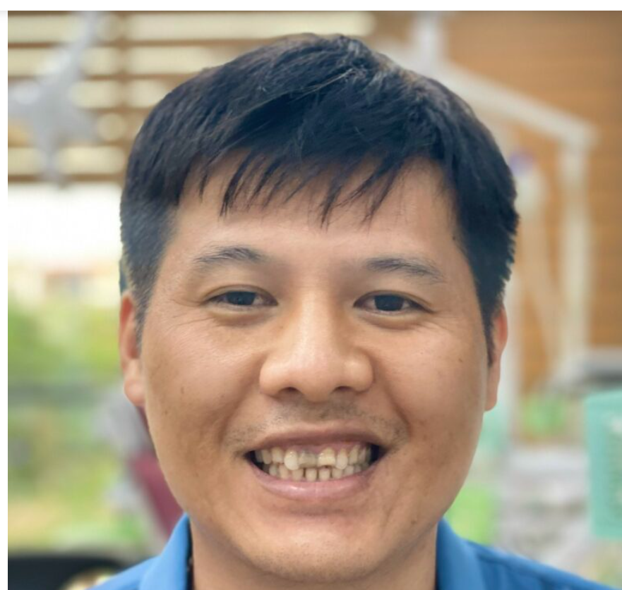 LẤY LẠI PHONG ĐỘ CHO NAM KHÁCH HÀNG CÓ NỤ CƯỜI KHUYẾT ĐIỂM