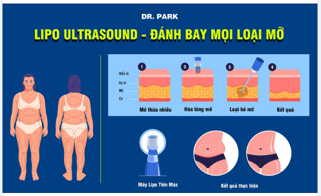 LIPO ULTRASOUND - ĐÁNH BAY MỌI LOẠI MỠ