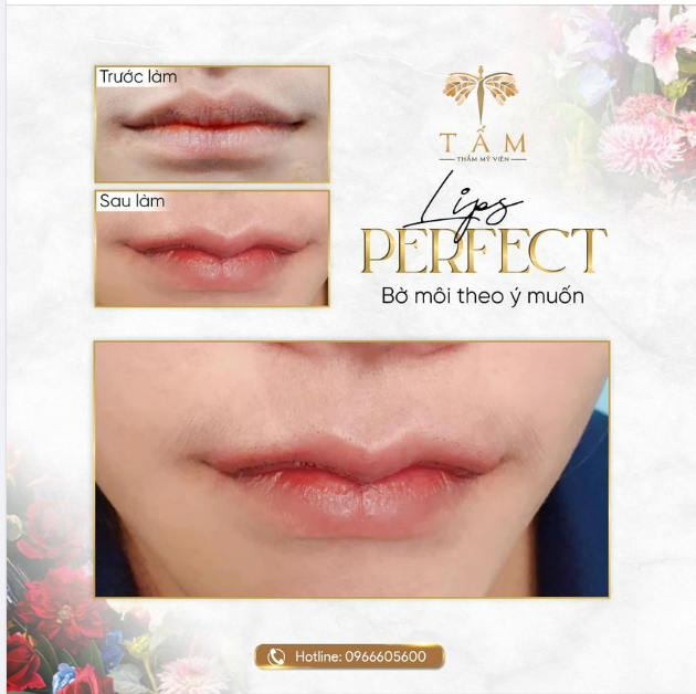 LIPS PERFECT - Bờ môi đúng như ý muốn của bạn