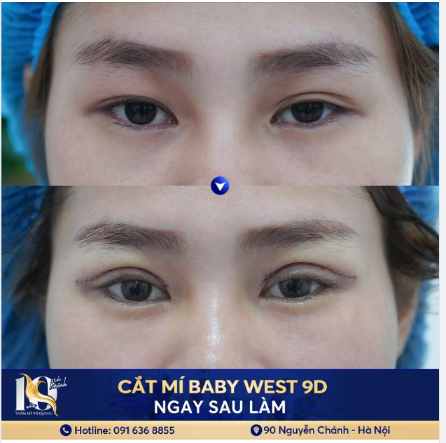 Mắt đẹp mí xinh - Nhan sắc lung linh