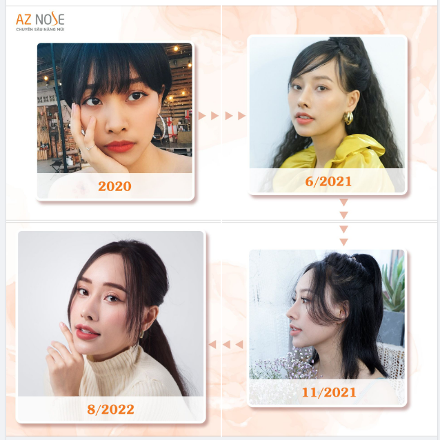 MC Mộc Miên tự tin toả sáng với dáng mũi Sline cao