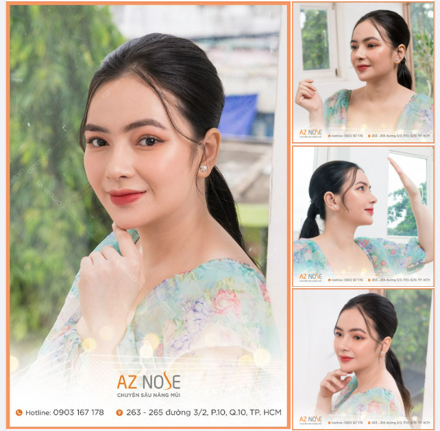 Mẹ bỉm đẹp sắc nét với dáng mũi Sline cao