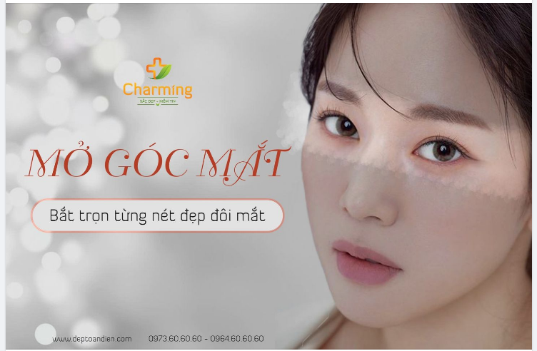 MỞ GÓC MẮT CHO ĐÔI MẮT VẸN NGUYÊN DÁNG HÌNH