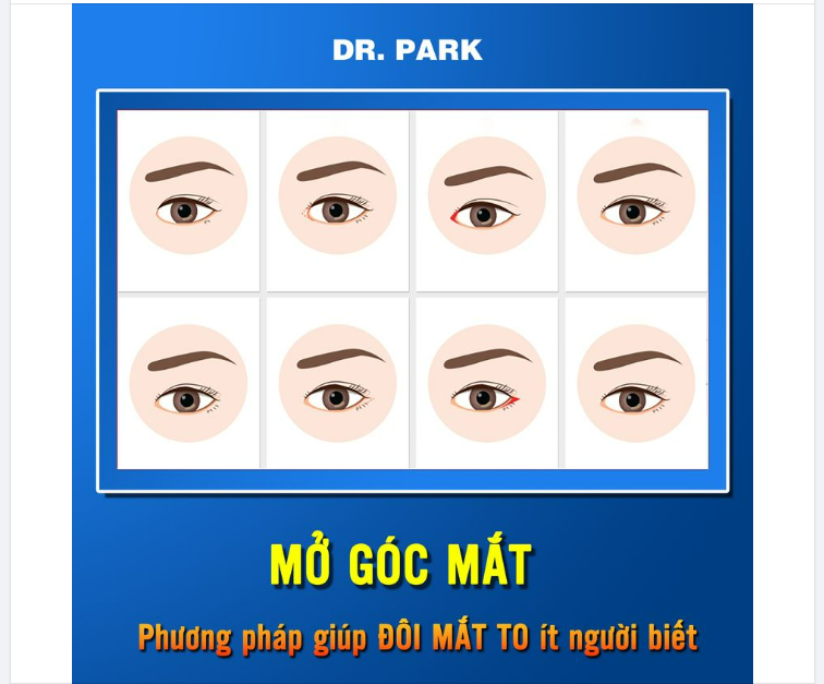 MỞ GÓC MẮT - PHƯƠNG PHÁP GIÚP MẮT TO TRÒN ÍT NGƯỜI BIẾT!