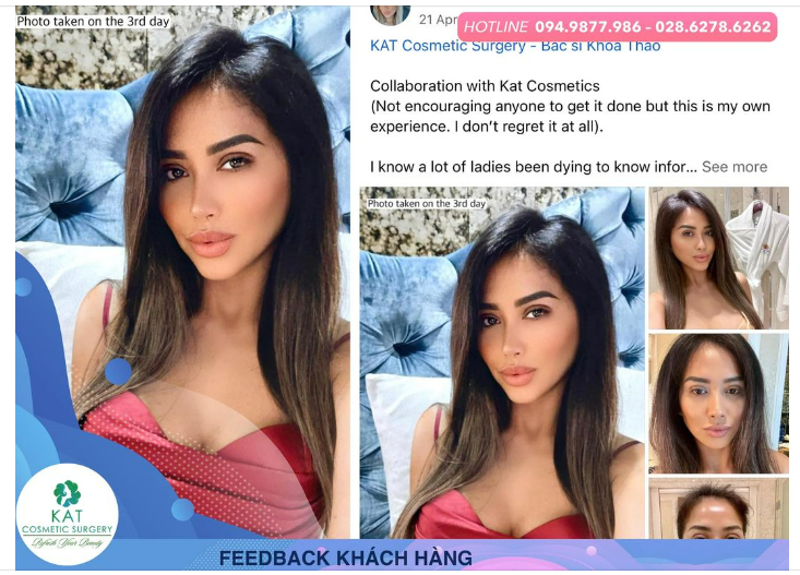 Một chiêc feedback đáng iu của Khách dành tặng cho KAT chỉ sau 3 ngày phẫu thuật tạo hình mí mắt .