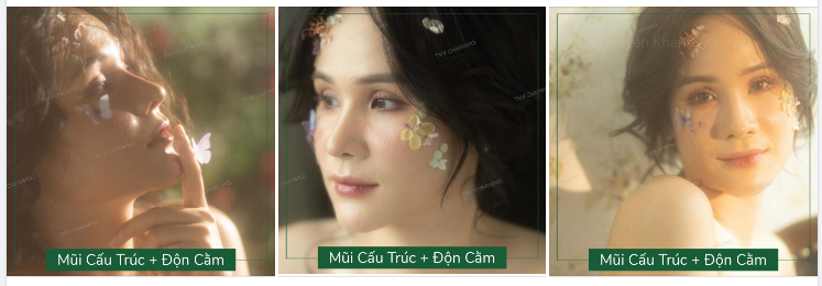 Một chiếc mũi L-line đầy cá tính, một chiếc cằm đầy kiêu kỳ đến từ vị trí của bs Khanh.
