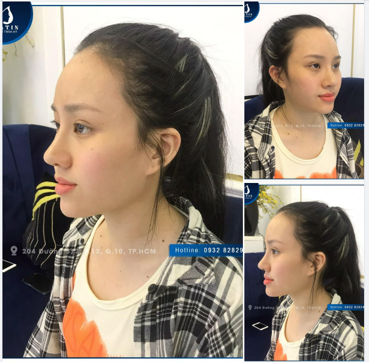 MŨI BÁN CẤU TRÚC 10 NGÀY SIÊU NÉT CHO BÉ KHÁCH DỄ THƯƠNG
