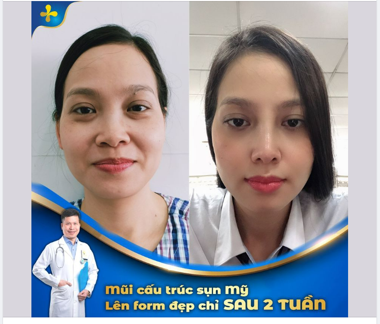Mũi được xếp vào hàng ngũ quan, bên cạnh các bộ phần khác là lông mày, mắt, tai và miệng; có liên quan đến vận mệnh, cuộc đời của mỗi người