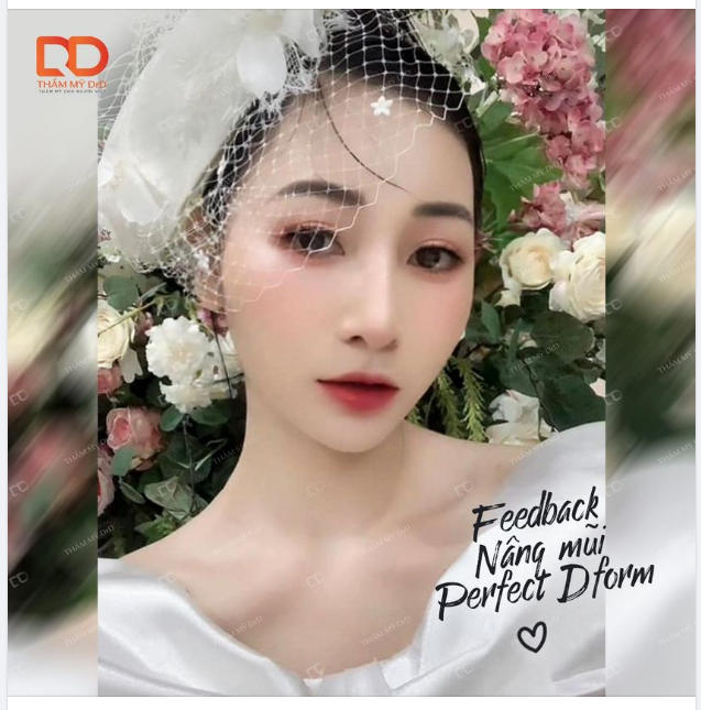 Mũi xinh lung linh ngày cưới. Nâng mũi để trở thành cô dâu xinh đẹp nhất trong ngày trọng đại của cuộc đời.
