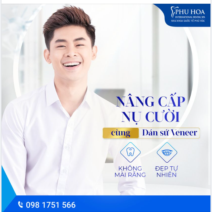 NÂNG CẤP NỤ CƯỜI CÙNG DÁN SỨ VENEER
